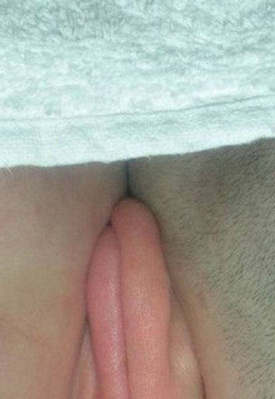   (3 )