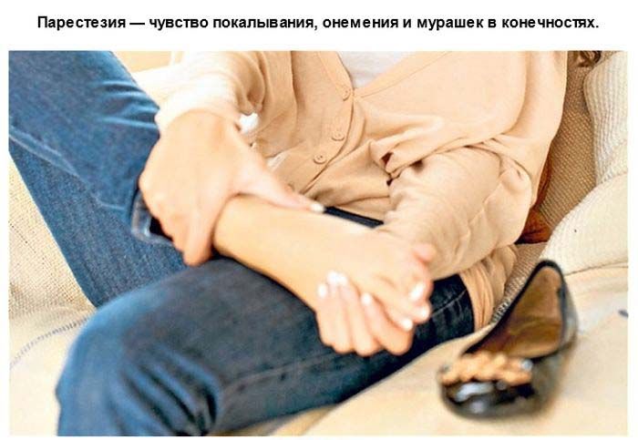 Что такое парестезия